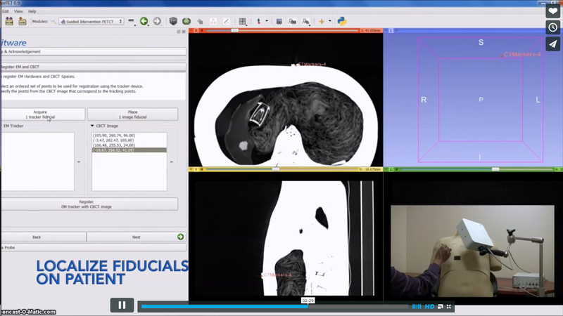 File:GuidedInterventionPETCT-videoNew.png